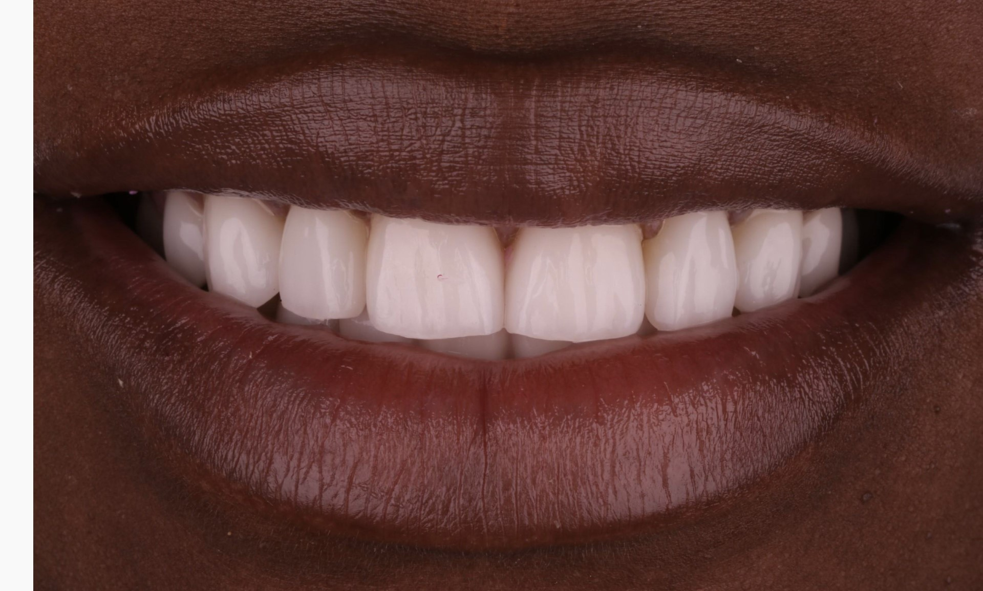 Harding Dental Group Harding Dental Group