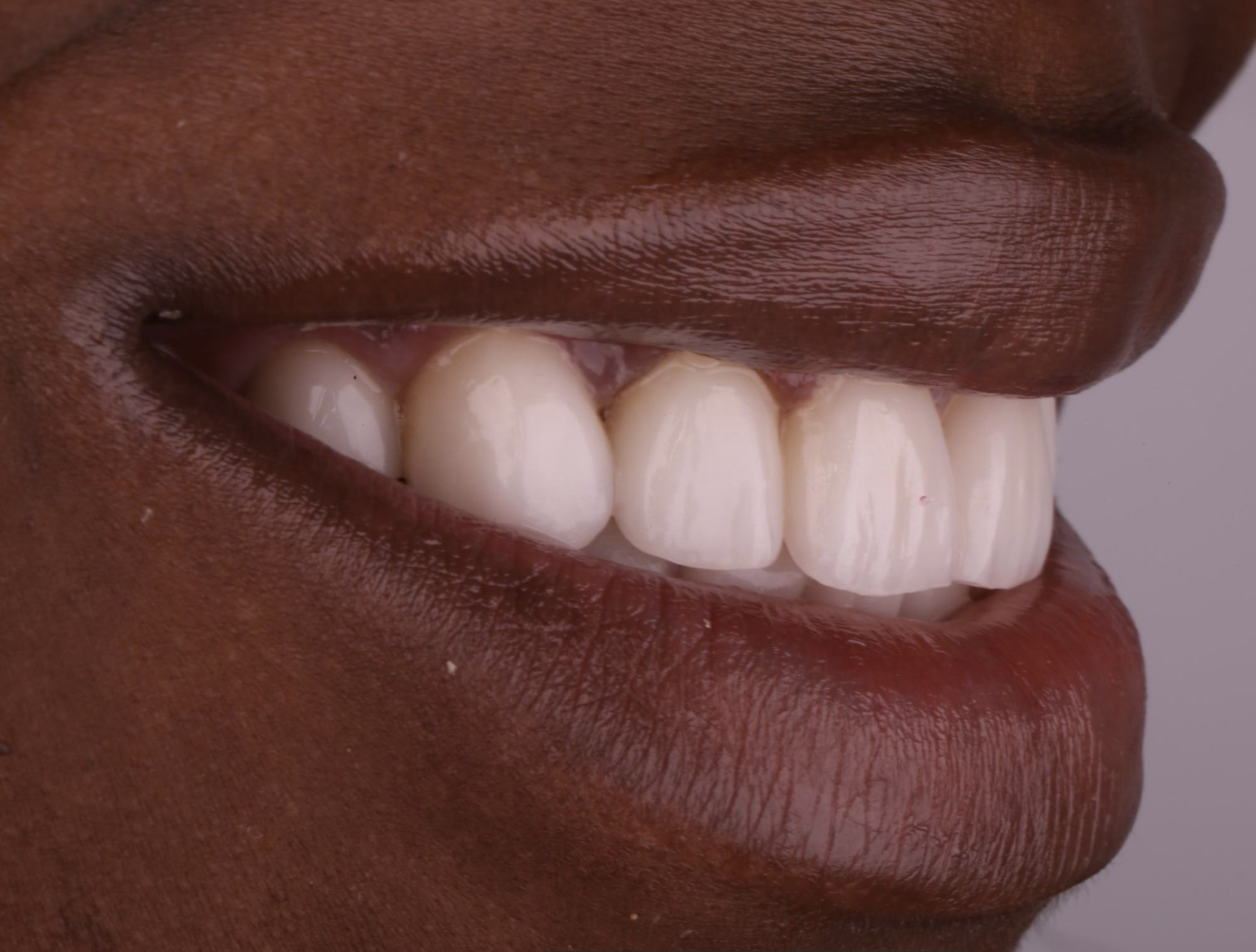 Harding Dental Group Harding Dental Group