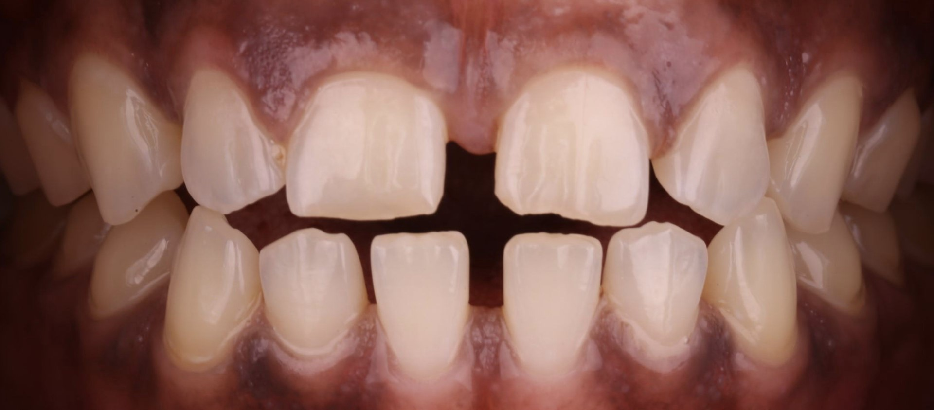 Harding Dental Group Harding Dental Group