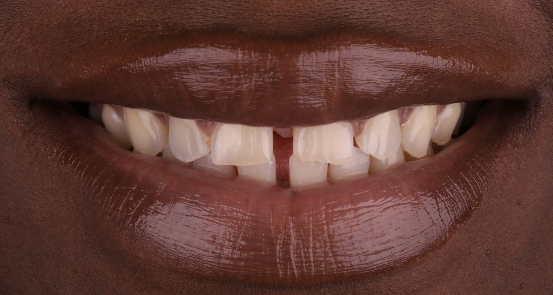 Harding Dental Group Harding Dental Group